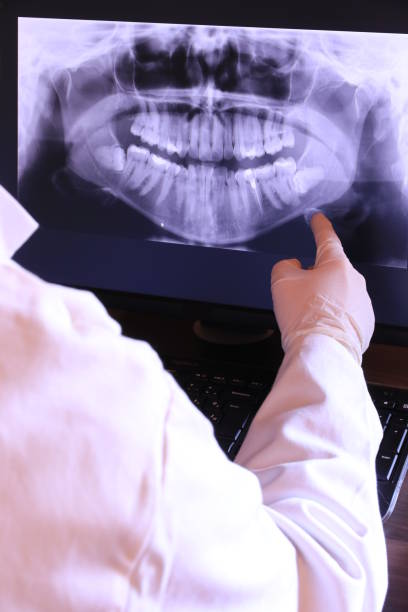 Best Knocked-Out Tooth (Avulsed Tooth) Treatment in East Brewton, AL